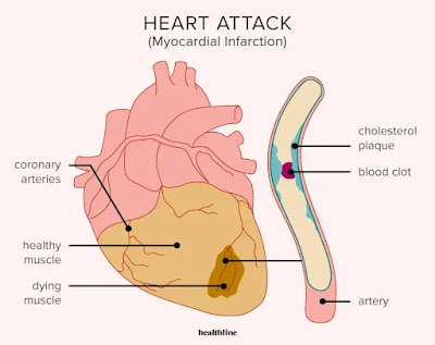 Organ heart