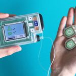 Technology In Artificial Pancreas: How Does It Work?