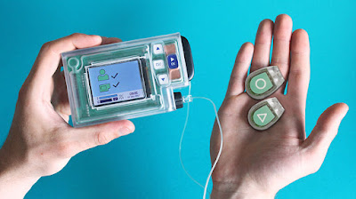 Technology In Artificial Pancreas: How Does It Work?