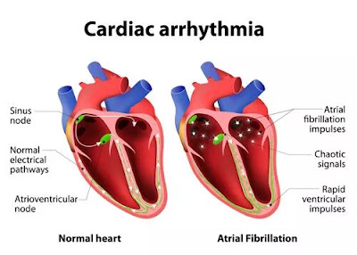 ORGAN HEART