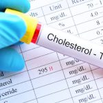 Is Lowering LDL Cholesterol By Diet Helpful?