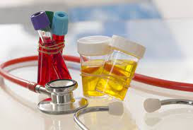 7 Earliest Signs of kidney disease and How to test Kidney function Signs of kidney disease