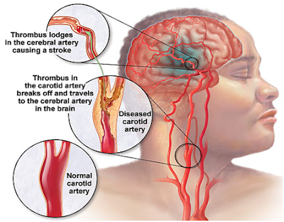 Organ brain