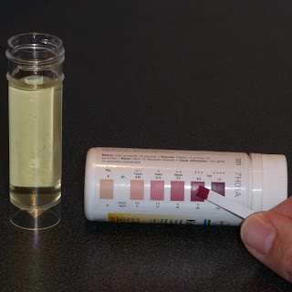 diabetes Ketones testing