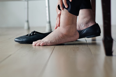 Charcot Foot: Causes Signs And Treatments