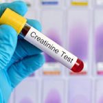 7 Effective Ways To Lower Creatinine Levels