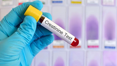7 Effective Ways To Lower Creatinine Levels
