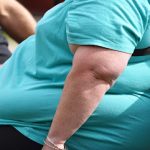 How Obesity Puts You At High Risk Of End-Stage Chronic Kidney Disease.