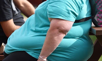 How Obesity Puts You At High Risk Of End-Stage Chronic Kidney Disease.