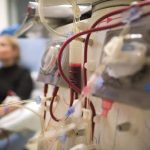 Understanding Hemodialysis: Risks And Preparing For Hemodialysis