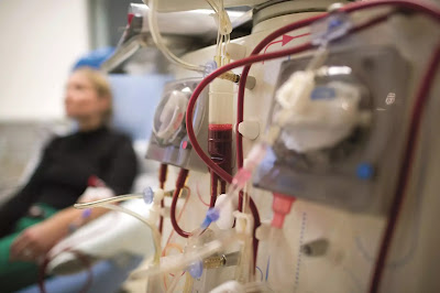 Understanding Hemodialysis: Risks And Preparing For Hemodialysis
