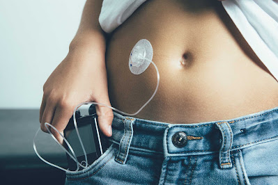 5 Disadvantages Of Insulin Pumps And How To Cope With Them