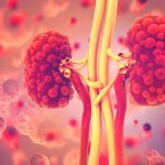 ADPKD and ARPKD: Definitions, Causes & Treatments