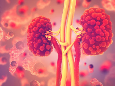 ADPKD and ARPKD: Definitions, Causes & Treatments