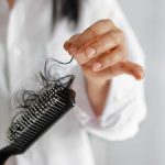 Diabetic Hair Loss: Causes And Solutions
