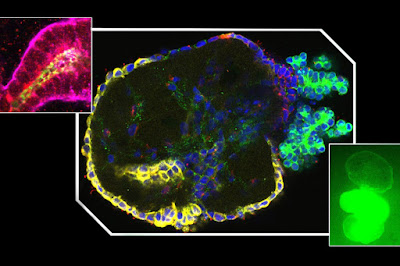 A New 3-D Model Sheds Light On The Function Of Sugar In PKD (polycystic kidney disease)