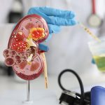Differences Between Renal Insufficiency And Renal Failure