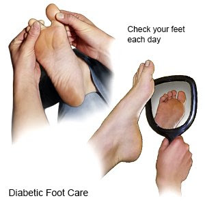 Diabetes Impact On Wound Healing