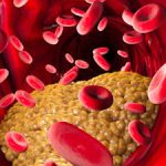 High Cholesterol Diet Is Linked With A Risk Of Type 2 Diabetes