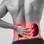 6 Symptoms of Kidney Stones & Risk Factors