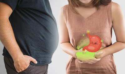 Foods and Drinks That Can Cause Bloating