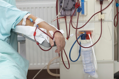 Kidney failure Patients May Benefit From A Wider Usage of High-Dose Hemodiafiltration