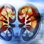 Chronic Kidney Disease (CKD) Stage 1: Causes, Symptoms And Treatment
