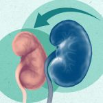 Can Kidney Damage Be Reversed? Exploring Generating possibilities