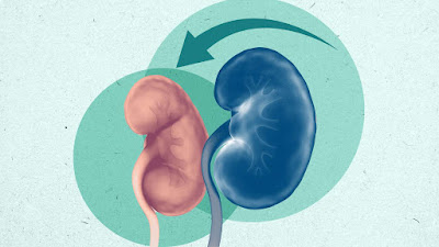 Can Kidney Damage Be Reversed? Exploring Generating possibilities