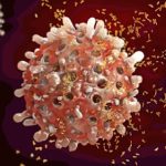 Autoimmune Diseases and their Impact on Kidney Health