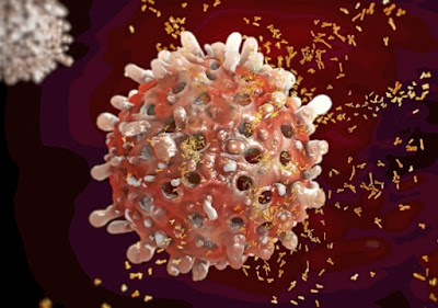 Autoimmune Diseases and their Impact on Kidney Health