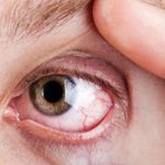 Diabetic Retinopathy: Causes, Progression, and Treatment Options