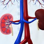 The Role of Inflammation in Kidney Disease
