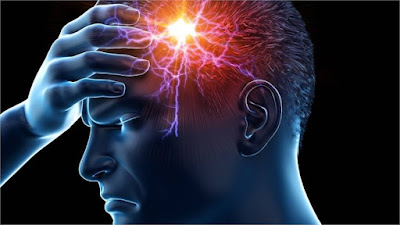 The Power of Magnesium Supplements for Migraine Prevention