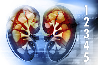 Chronic Kidney Disease (CKD) Stage 5: Causes, Symptoms And Treatment