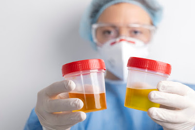 How to Reduce Proteinuria in Chronic Kidney Disease: Practical Tips and Strategies