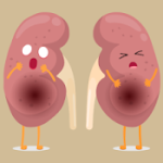 How to Avoid Nephrotoxic Substances