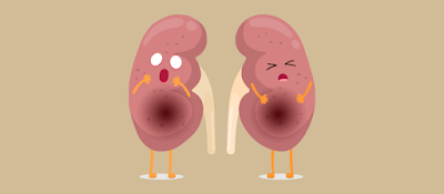 How to Avoid Nephrotoxic Substances