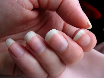 Unlocking the Power of Collagen for Stronger Nails