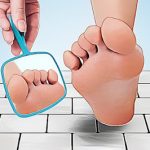 How to Recognize and Treat Diabetes-Related Foot Problems