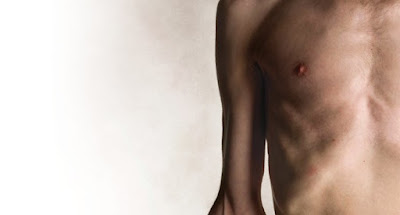 Preventing Malnutrition in Chronic Kidney Disease (CKD)