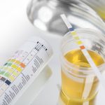 How to Interpret Kidney Function Test Results