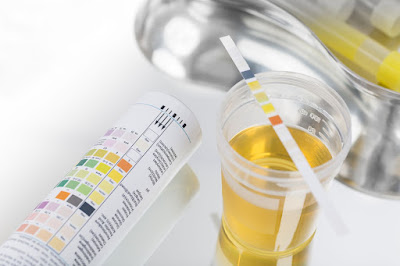 How to Interpret Kidney Function Test Results