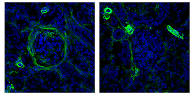 Unraveling Lupus Nephritis: The Surprising Role of Innate Lymphoid Cells