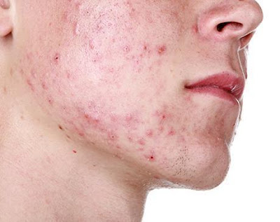 Skin Conditions Recommended Treatments