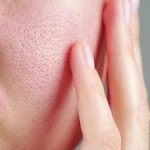 Effective Methods for Minimizing Pores