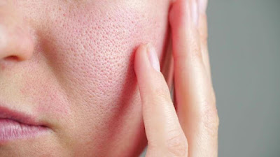 Effective Methods for Minimizing Pores
