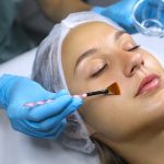 Introduction to Chemical Exfoliation: A Comprehensive Guide