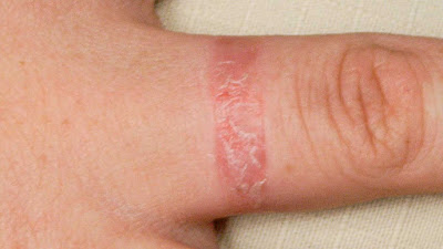 Skin Conditions Recommended Treatments
