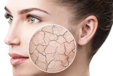 Dealing with Dry Skin: Causes and Solutions